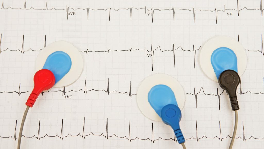 REGISTERED EKG SPECIALIST (RES)